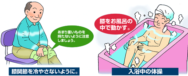 変形性膝関節症