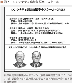 シンシナティ病院前脳卒中スケール