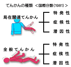 てんかんの種類