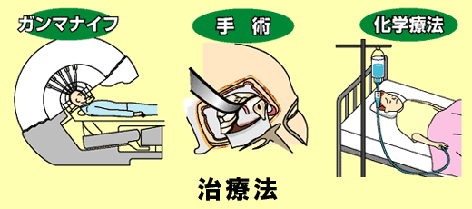 治療法