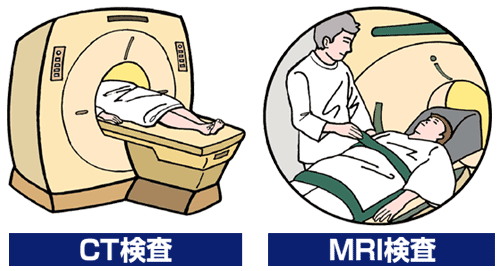 CT検査・MRI検査