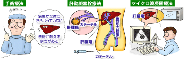 治療法