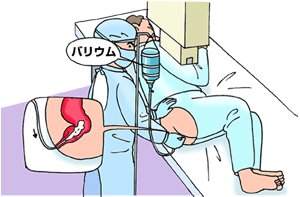 注腸検査