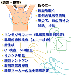 乳がんの検査