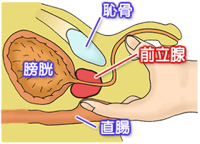 前立腺指診