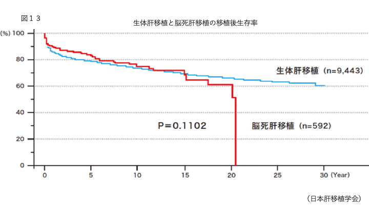 肝移植中に何が起こるのですか?